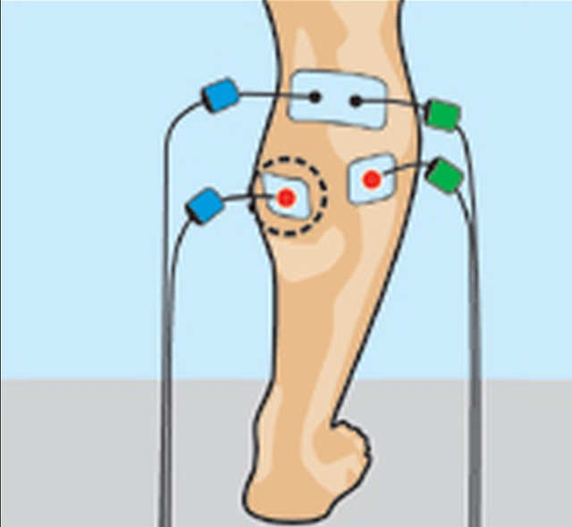 Prevenir calambres en las piernas con electroestimulación