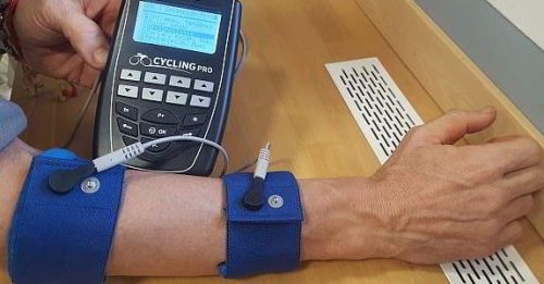 electroestimulacion epicondilitis y microcorriente