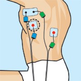 Entrenamiento con electroestimulacion para natacion. Dorsal