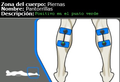 Colocación de electrodos electroestimulacion en https://www.electroestimulaciondeportiva.com/