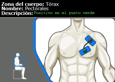 Colocación de electrodos electroestimulacion en https://www.electroestimulaciondeportiva.com/