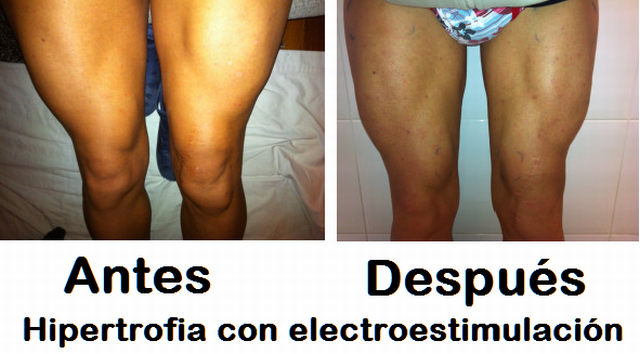 hipertrofia muscular con electroestimulacion