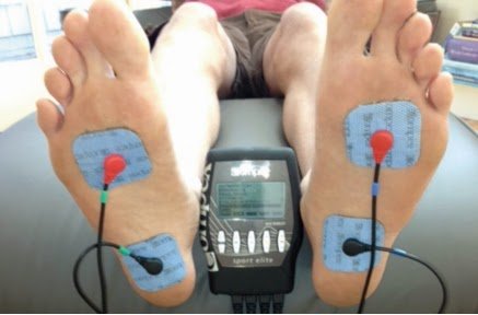 tratamiento electroestimulación fascitis plantar