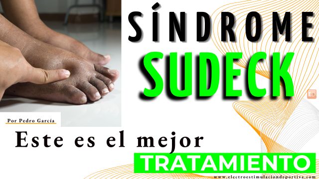 El mejor tratamiento para el sudeck