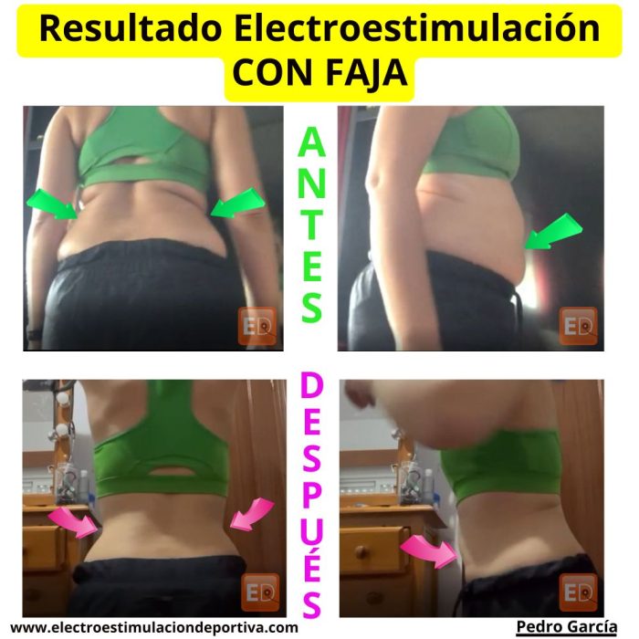 eliminar grasa abdominal con electroestimulación antes después electroestimulación para perder peso antes despues