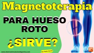 Magnetoterapia hueso roto