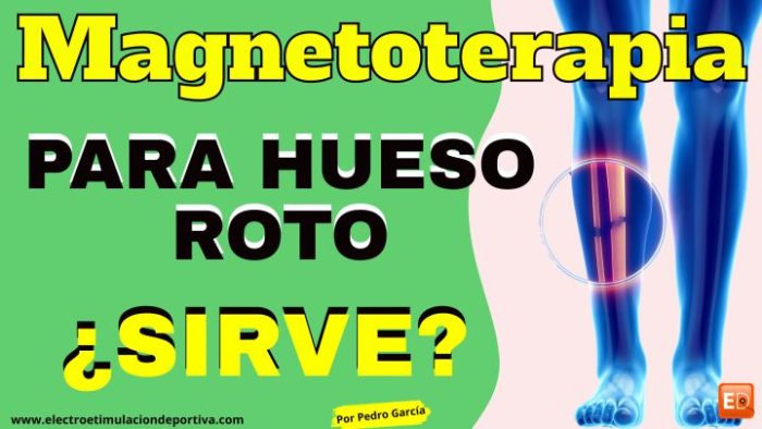 Magnetoterapia hueso roto