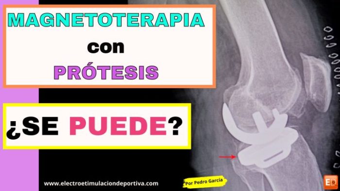 Magnetoterapia y prótesis: ¿son compatibles?