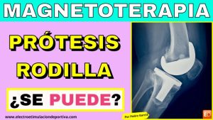 ¿Se puede usar magnetoterapia con una prótesis de rodilla?