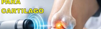 Magnetoterapia para regenerar el cartílago: ¿funciona realmente?