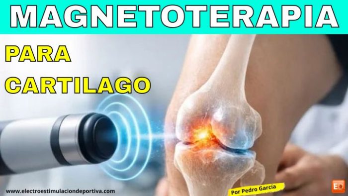 Magnetoterapia para regenerar el cartílago: ¿funciona realmente?