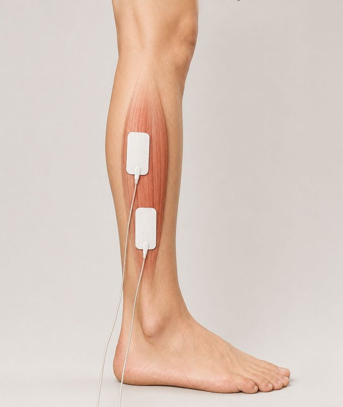 Electroestimulador pie caido ictus