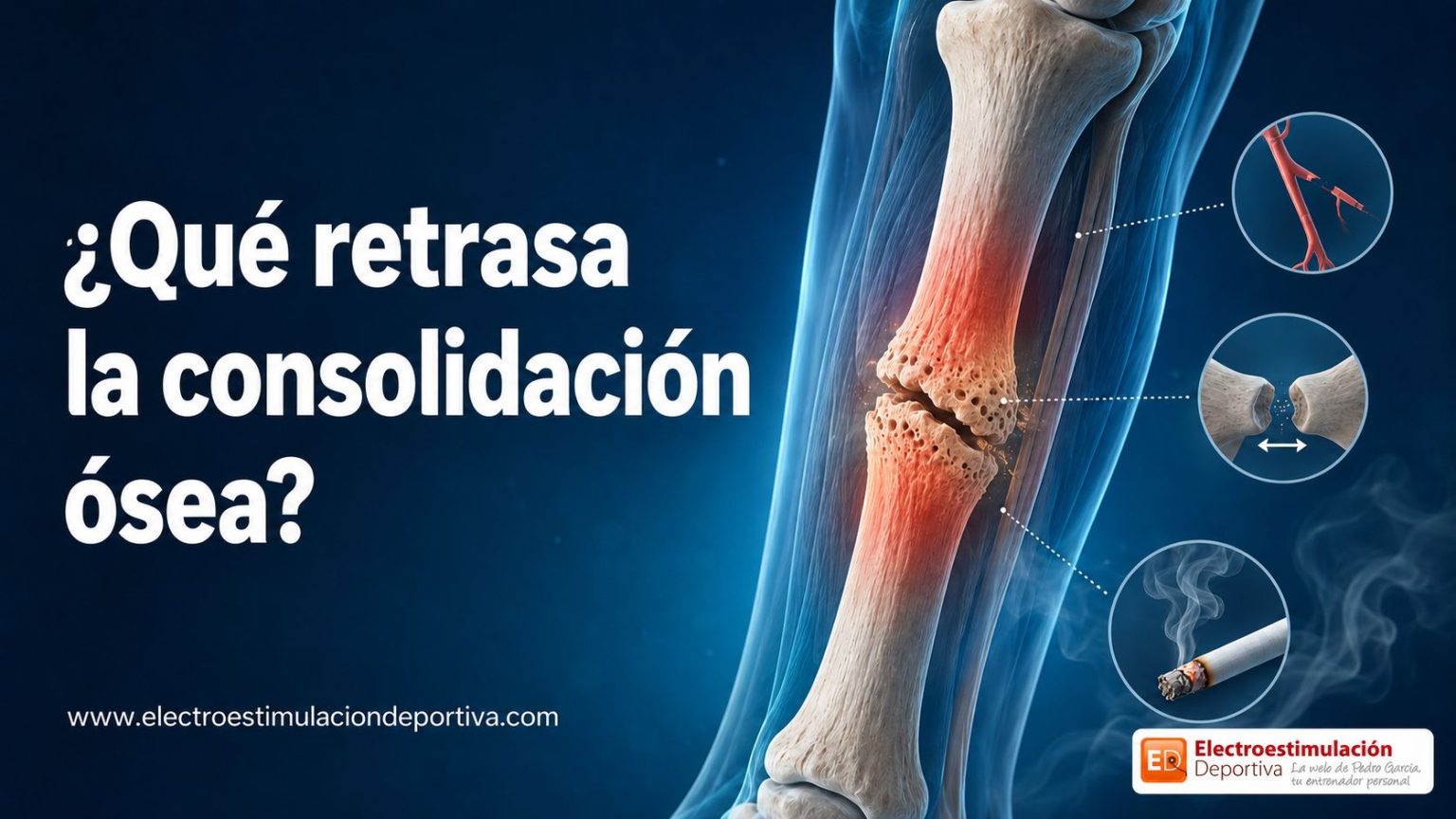 Por qué se retrasa la consolidación ósea