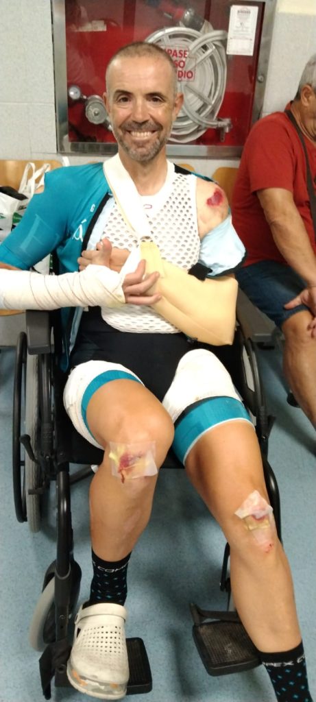 clavícula rota por caida de bicicleta