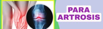 ¿Funciona la magnetoterapia cuando hay artrosis?